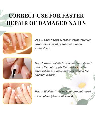 TBeautfave Fungal Nail Treatment Toe Nail Fungal Treatment Nail Fungus Treatment for Toenail Nail Fungal Solution Fixes Discolored Nails Nail Strengthener for Weak Nails Nail Repair Nail Care - Buy Online on GoSupps.com