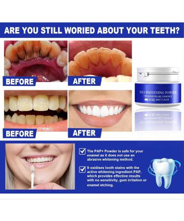 Tooth Elevator Powder - Effective Stain Remover for Whiter Teeth | Prevents Yellowing & Removes Plaque | Safe Mild Ingredients for All Users - Buy Online on GoSupps.com