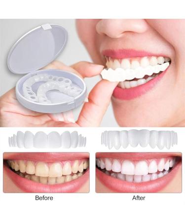 Brigtviee Clipin veneers 2 pairs of instant veneers upper and lower dentures Confidence Smile prostheses comfortable veneers for men and women - Buy Online on GoSupps.com