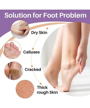 Buy Sukh 20pcs Pumice Stone Set - Foot Scrubber for Dead Skin | Spa Quality Foot Care Kit for Men & Women - Heavy Callus Remover - Buy Online on GoSupps.com