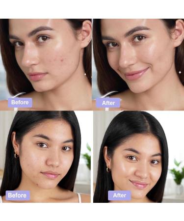 Madecassoside Toner Pads Mild Exfoliating Pads Calming Blemish Face Pad -Centella Niacinamide BHA Salicylic Acid for Soothe Uneven Skin Tone Dark Spots Skincare 125 Pad Valentines Day Fresh - Buy Online on GoSupps.com