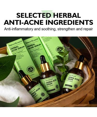 Rosarden Anti Acne Serum for Face Natural Herbal Face Serum for Improvement Pimples Pore Acne Scar Anti Pimple Serum Face Care for All Skin Types of Acne - Buy Online on GoSupps.com