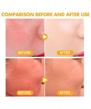 Mineral Sunscreen Setting Powder SPF 35 - Translucent Oil Control Matte Loose Powder for Face | Lightweight & Breathable (02# Medium) - Shop Internationally - Buy Online on GoSupps.com