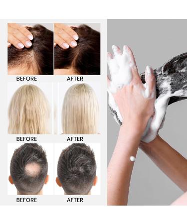 Rice Water & Rosemary Oil Shampoo for Hair Growth | Biotin Anti Hair Loss Treatment for Men & Women | Regrowth Formula for All Hair Types - Buy Online on GoSupps.com