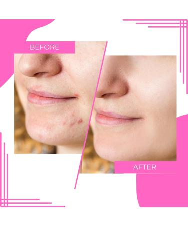 Aha Pha Bha 32% Serum | Reduce Fine Lines Wrinkles & Dead Skin | Exfoliate for Brighter Youthful Skin - Shop Internationally - Buy Online on GoSupps.com