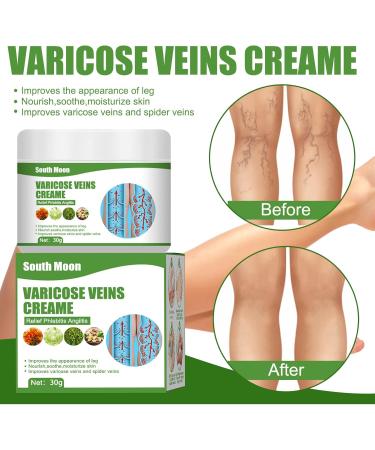  Katutude Repair cream for varicose veins and spider veins. Varicose vein cream to relieve varicose veins and spider veins. - Buy Online on GoSupps.com