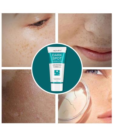 Dark Spot Corrector Cream for Face - Fade Black Precipitates, Remove Freckles & Spots - All Skin Tone Types - Buy Online on GoSupps.com