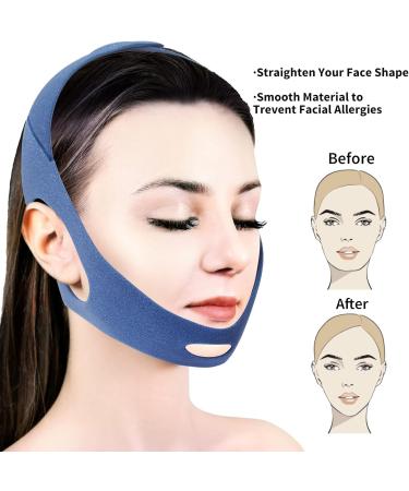 2023 Upgraded Anti Snoring Chin Strap - Adjustable Stop Snore Aid for Men and Women - Effective Relief for Dry Mouth and Noise - Breath Easy with Professional Sleep Support (Blue) - Buy Online on GoSupps.com
