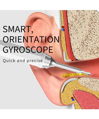 Buy Ear Wax Removal Tool - 1080P HD Visual Ear Sampler WiFi Ear Picker & Gyroscope Cleaner (Pink) | International Shipping - Buy Online on GoSupps.com