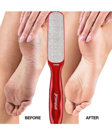 Probelle Double Sided Multidirectional Nickel Foot File Callus Remover - Instantly Eliminate Calluses and Corns - Safe and Effective (Red) - Buy Online on GoSupps.com