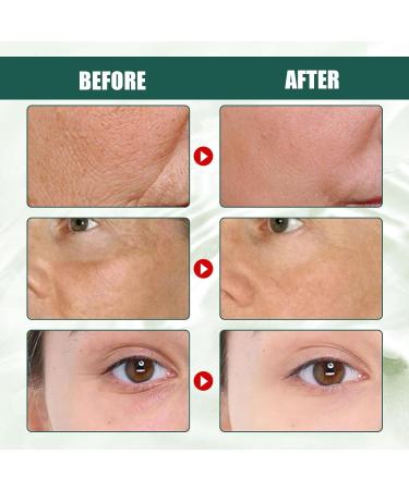 Deep antiwrinkle serum fades the fine lines of the corner of the eyes hydrates firms softens and brightens the skin 30ml - Buy Online on GoSupps.com