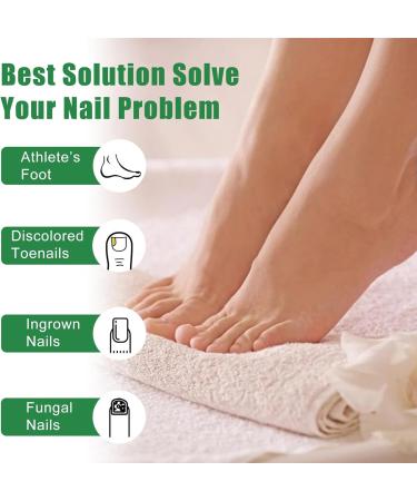 Fungal Nail Treatment For Toenails - Extra Strong Nail Fungus Treatment For Anti Fungal Nail Treatment - Fungal Nail Polish For Fix & Renew Damaged Broken Nails - Buy Online on GoSupps.com