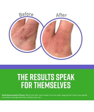 O'Keeffe's Working Hands Night Treatment Hand Cream 3.0 oz - Repair & Moisturize - Buy Online on GoSupps.com