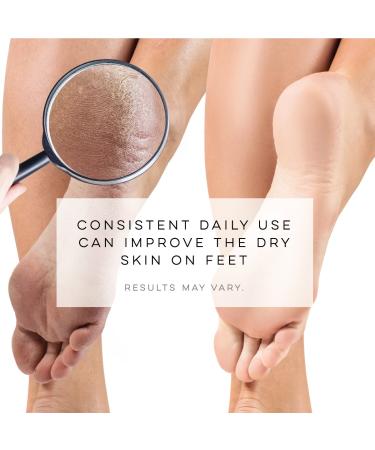 LE EMILIE 5 Toe Moisturizing Gel Socks | Healing Dry Cracked Heels | Lavender & Jojoba Oil Blend | 1 Pair Green Seafoam - Buy Online on GoSupps.com