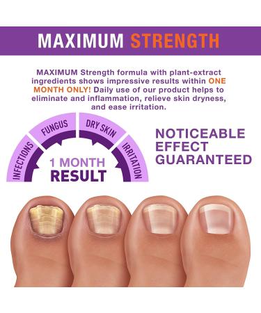 Toenail Fungus Revitalizer - Advanced Formula for Fast Relief & Healthy Nails - Buy Online on GoSupps.com
