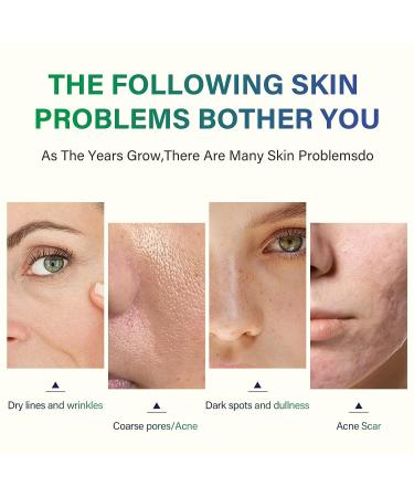 40% Citric Acid Peeling Serum | Chemical Peel for Face, Skin Exfoliant for Dark Spots & Acne | 30ml/1 Fl oz - Buy Online on GoSupps.com