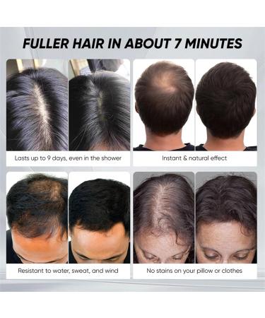  Nuhjytgf Concealer Cream for Hair Waterproof Coverage 30ml Black Scalp Coverage Solution Bald Spot Corrector Sweat Resistant and Natural Look For Use - Buy Online on GoSupps.com