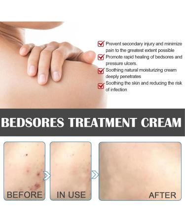  JPSDOWS Anti-Decubitus Cream | Anti-Decubitus Care 20g Healing Cream for Raping Pain Relief for Irritated Skin Difficult to Heal Skin - Relief Jpsdows - Buy Online on GoSupps.com