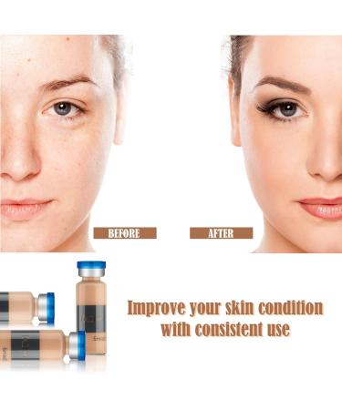 BB Facial Glow Starter Kit | Anti-Aging Pigment Serum Treatment - Micro-Needling Essentials 10 Vials 5ml with Hyaluronic Acid - Buy Online on GoSupps.com