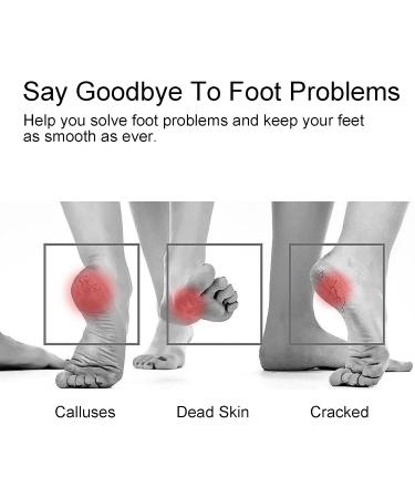 Acpetdr Foot File Glass Foot Callus Remover Callus Remover and Heel Scraper Foot Grinding Scraper Foot Scrubber for Wet and Dry feet Removal Hard or Dead Skin for Women or Men - Buy Online on GoSupps.com