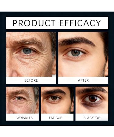 Retinol Eye Serum for Men Reduce Dark Circles & Puffiness Anti Aging Under Eye Cream with Glycerin & Retinol Hydrating Eyes Treatment for Wrinkles & Fine Lines Firming Bright Eyes Care (2pcs) - Buy Online on GoSupps.com