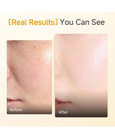 CDL Silk Tangle Collagen Lifting Face Cream - Instant Firming & Plumping for Sagging Skin with Peptides Ceramide Deep Hydration with Hyaluronic Acid - Pore Care & Elasticity - Korean Skincare - Buy Online on GoSupps.com