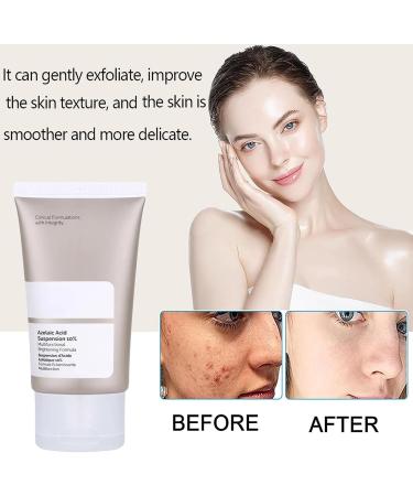 Azelaic Acid Cream Face Skin Care Beauty with Niacinamide & Vitamin C Azelaic Acid Suspension 10% Face Serum Reduce Blemishes Remove Acne&Rosacea Shrink Pore Face Cream for All Skin Types 30ML (1) - Buy Online on GoSupps.com