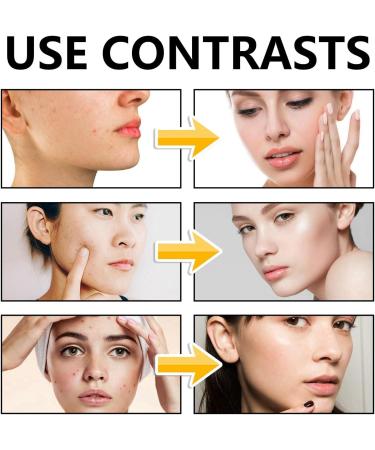 Low PH Gentle Cleanser Cleanser Woman Gentle Moisturising Cleanser Moisturising Face Wash Deep Cleansing Facial Wash Low PH Gel Cleanser Exfoliating Face Wash for Women Cleansing Oil for Face - Buy Online on GoSupps.com