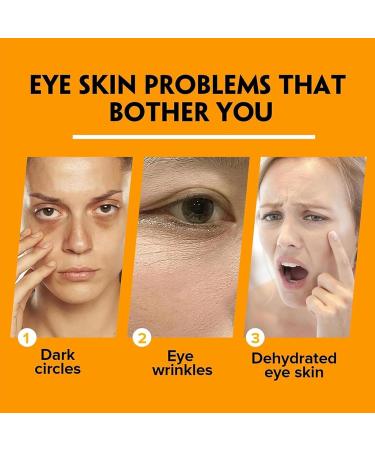 Lumi Stick for Eye Bags Lumistick for Eye Bags Eye Balm Stick Hydrating for Puffiness and Bags Reduces Turmeric Eye Stick Lumistick Eye Cream Stick for Reduces Fine Lines Turmeric Eye Cream Stick - Buy Online on GoSupps.com