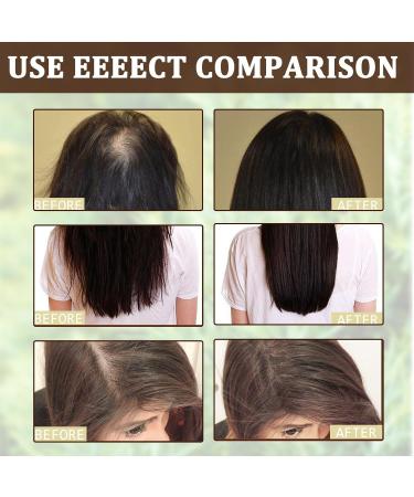 MieIIe Rosemary Oil for Hair Organic Rosemary Mint Scalp & Hair Strengthening Oil for Hair Growth Split End Treatment Dry Scalp - Buy Online on GoSupps.com