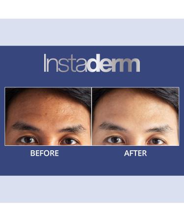 Anti-Aging Exfoliating Peel Pads with Glycolic, Lactic, and Salicylic Acid - Smooth Fine Lines, Wrinkles, Dark Spots & Enhance Skin Texture - Buy Online on GoSupps.com