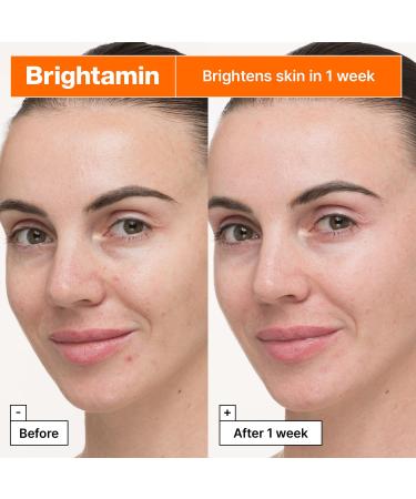 Dr.Jart+ Brightamin Brightening Korean Vitamin C and Niacinamide Serum For Visible Fine Lines | Dark Spot Correcting Glow Serum | Korean Skin Care 0.27 Fl Oz - Buy Online on GoSupps.com