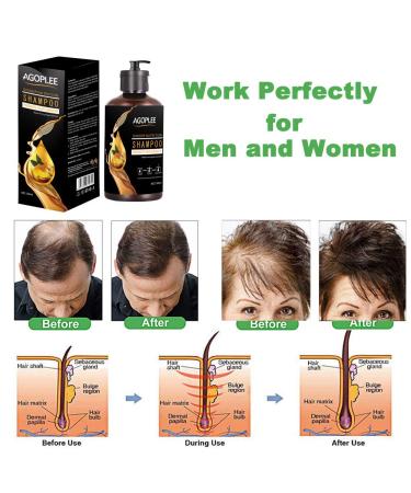 Natural Hair Loss Treatment Shampoo - Promotes Hair Growth & Prevents Loss - Old Ginger Formula - 10OZ - Buy Online on GoSupps.com