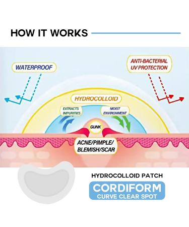 Acne Patches for Pimples & Blemishes Derma-Aid Facial Stickers for Clear Skin | Cordiform - Buy Online on GoSupps.com