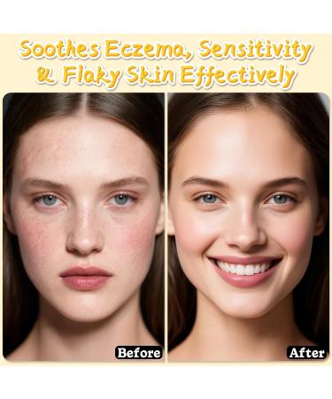 Beef Tallow for Skin Tallow and Honey Balm for Face Skin Care Cream Body Butter Natural Formula Nourish and Soothe Dry Skin 120g/4.2oz - Buy Online on GoSupps.com