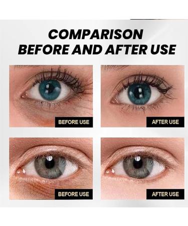 Binozity Skin Tightener Binozity Temporary Face Tightener Instant Firm Face Temporary Eye Tightener Binozity Under Eye Cream Binozity Eye Cream Improves Puffiness And Puffy Eyes (2) - Buy Online on GoSupps.com