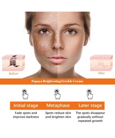 OLLZPJFPK Papaya Whitening Freckle Cream Lightens Facial Freckles Dark Spots Brightens Moisturizes Skin Day and Night Cream - Buy Online on GoSupps.com