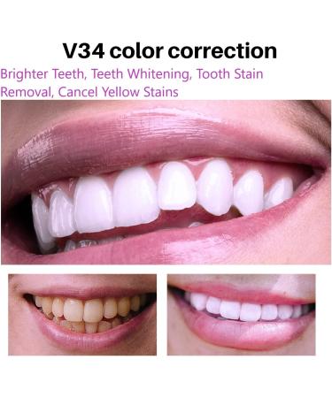 Teeth Whitening Mousse V34 - Brighten Your Smile | International Shipping Available - Buy Online on GoSupps.com
