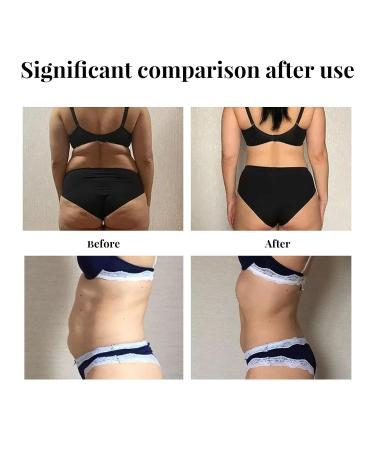 VIAZ 30 Day Tummy Tightening Cream - Belly Firming Anti Cellulite Fat Burner - Natural Ingredients (3 PCS) - Buy Online on GoSupps.com