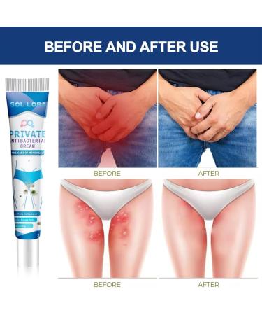Antibacterial Ointment Anti-fungal Cream For Men and Women's groin Pruritus Cream For Private Parts Deodorizing Anti-Fungal Cream And anti-Fungal Cream For Quick itching 20g - Buy Online on GoSupps.com