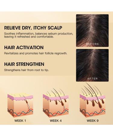 Anti Hair Loss Shampoo - Nourishing Ginger Hair Growth Treatment for Men & Women | Volumizing Regrowth with Herbal Essences Rose & Castor Oil - 16.8 fl. oz - Buy Online on GoSupps.com