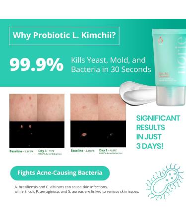 Norie Ultra-Clean Gel Kimchii Cleanser - Fragrance Free Award-Winning Probiotic Formula for Softer Clearer Skin - International Shipping Available - Buy Online on GoSupps.com