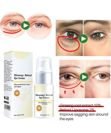 Retinol Eye Cream - Eye Cream for Dark Circles and Puffy Eyes - Ginseng Eye Cream Anti Aging - Eye Bags Remover Smooth Wrinkle Fade Fine Line - Moisture Hydrate Plump Elasticity Radiance Complexion - Buy Online on GoSupps.com