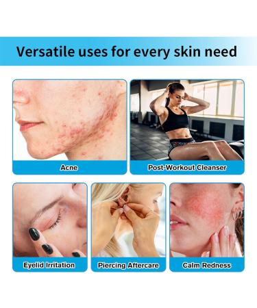  Ceprznvey Women Hydrating Skin Liquids Hypochlorous Acid Spray Daily Rescue Facial Spray Hydrating Face Care Spray for Sensitive Skin Soothing Toner 65 ml 3 Years Shelf Life - Buy Online on GoSupps.com