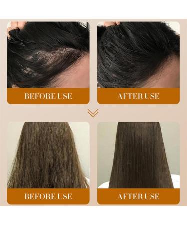 Sadoer Ginger Anti-Hair Loss Oil & Shampoo Set | Hair Growth Serum for Thicker Stronger Hair | Men's & Women's Treatment - Buy Online on GoSupps.com