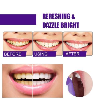 50ml Teeth Whitening Mousse - Stain Removal Breath Freshener & Color Corrector Foam for Perfect Smiles - Buy Online on GoSupps.com