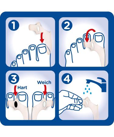 Hallux Valgus Plus 2in1 Pressure Protection - Burgit Gel Pads & Wedges for Pain-Free Walking - 4 Gel Pads & 6 Wedges - One Size - International Shipping - Buy Online on GoSupps.com