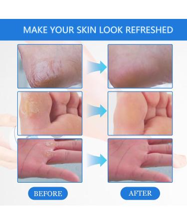 Electric callus remover callus remover foot care device pedicure set foot care callus remover callus remover foot care device with 6 attachments - Buy Online on GoSupps.com