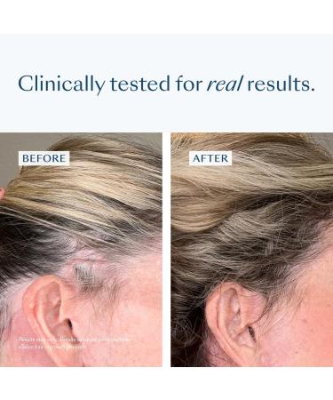 eSalon Biotin Hair Gummies Multivitamin Cherry Flavor 60 Count 30 Day Supply - Buy Online on GoSupps.com