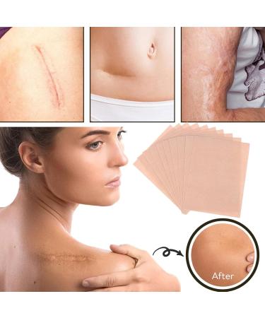 Scar Cover up Tape | Scar Concealing Tape - Long Lasting Scar Concealing Tape Skin Invisible Concealer Sticker Invisible Flaw Conceal Sticker for Hide Skin Spots Skin Color - Buy Online on GoSupps.com